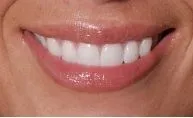 Preceision Dental Care in Dry Ridge KY