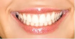 Preceision Dental Care in Dry Ridge KY