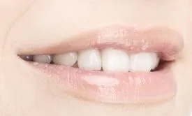 Preceision Dental Care in Dry Ridge KY
